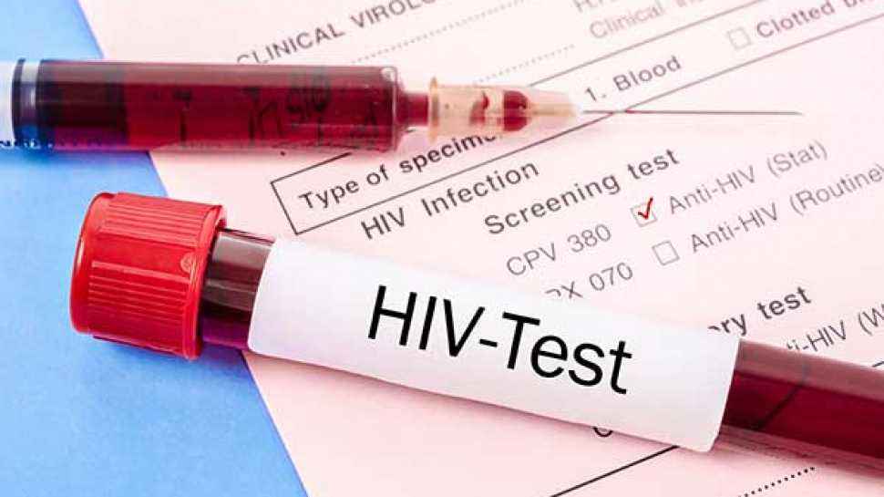 What Should You Do Before Taking an HIV Test?